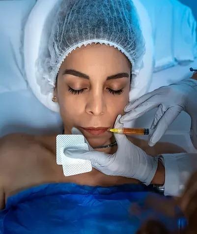 Dermal Fillers Miami